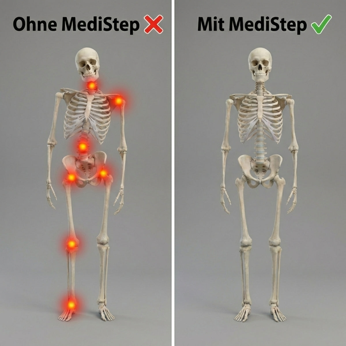 MediStep